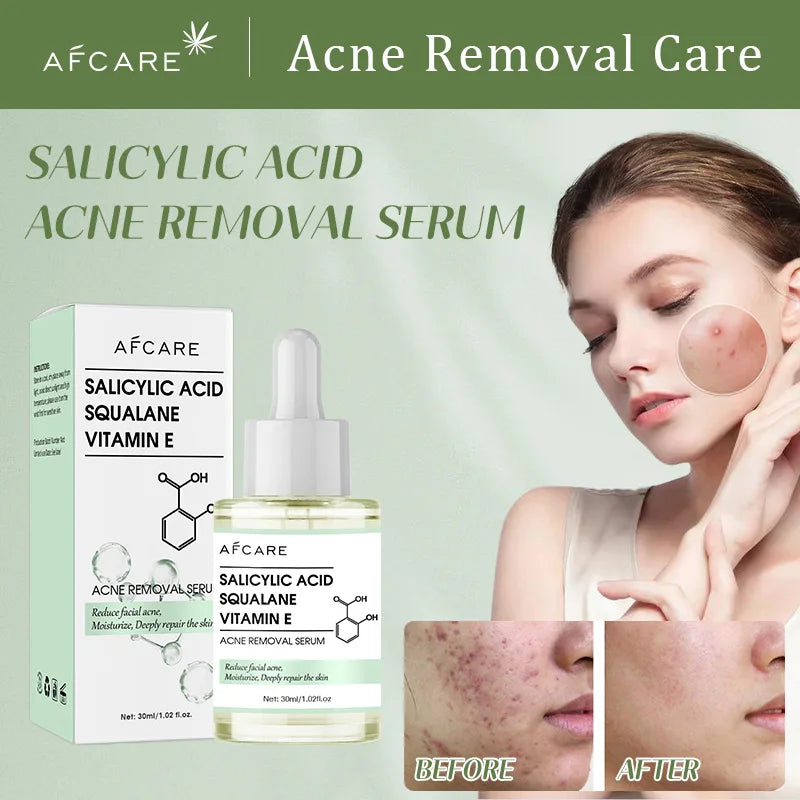 Salicylic Acid Acne Removing Essence Face Serum